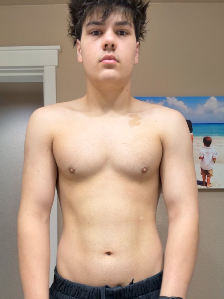 Logan front pose, before